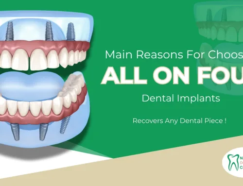Main Reasons For Choosing ALL ON FOUR Dental Implants in Donegal, PA