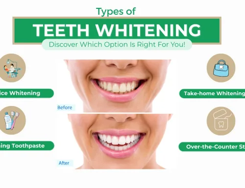Types of Teeth Whitening in Export, PA