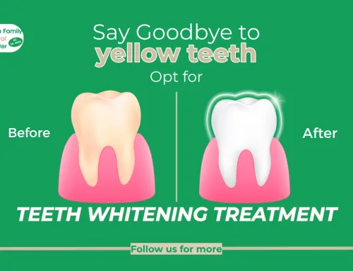 Say Goodbye to yellow teeth in Export, PA